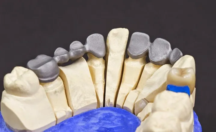 o que é uma prótese dentária fixa