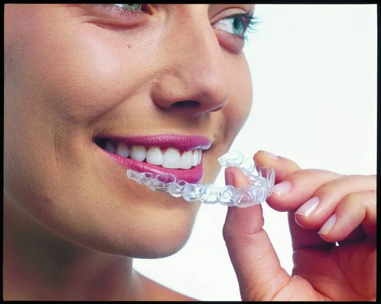 Invisalign, Saiba tudo sobre esse aparelho