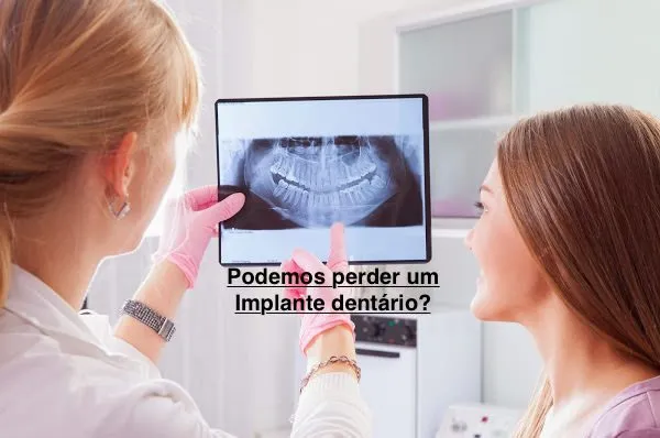 Posso perder um Implante Dentário ?