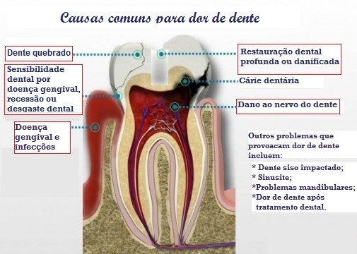 causas dor de dente 