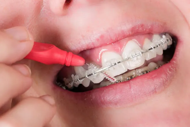 como-passar-o-fio-dental