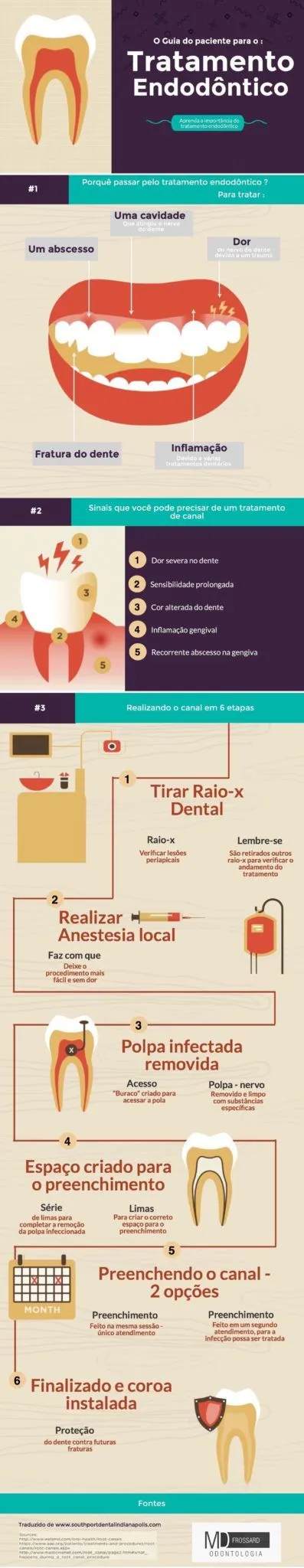 Infografico tratamento de canal