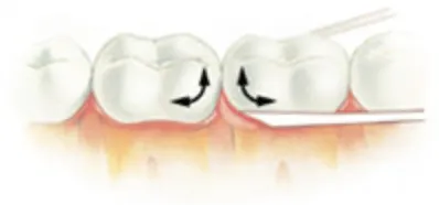como passar o fio dental