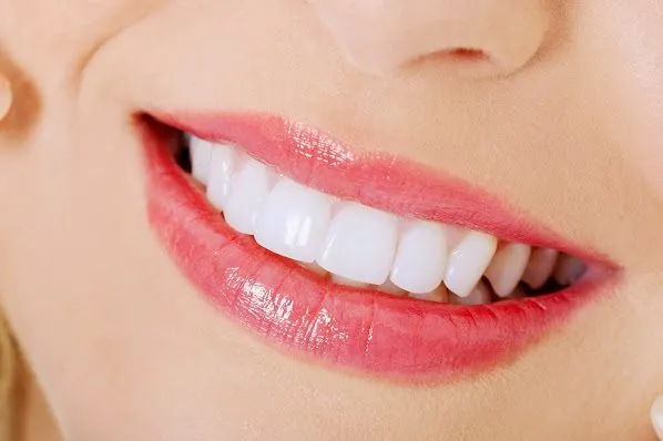 Faceta de Porcelana - 5 Razões para mudar seu sorriso