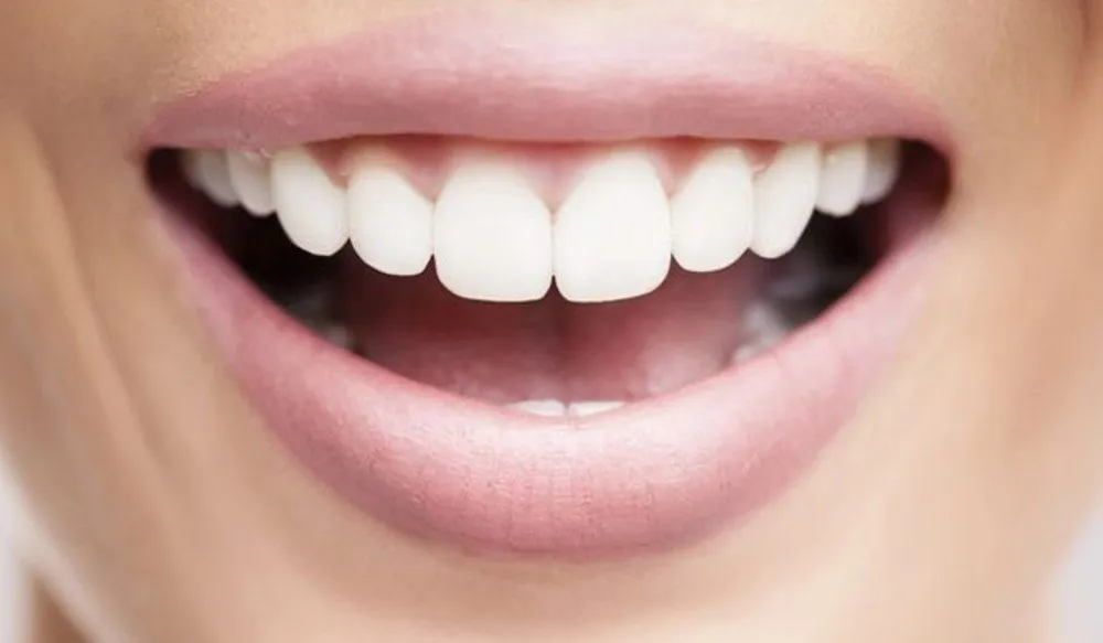 5 Dicas de Saúde Bucal