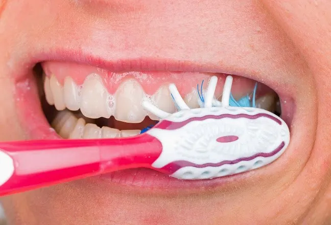 Canal no dente - Afinal quando é preciso realizar ?