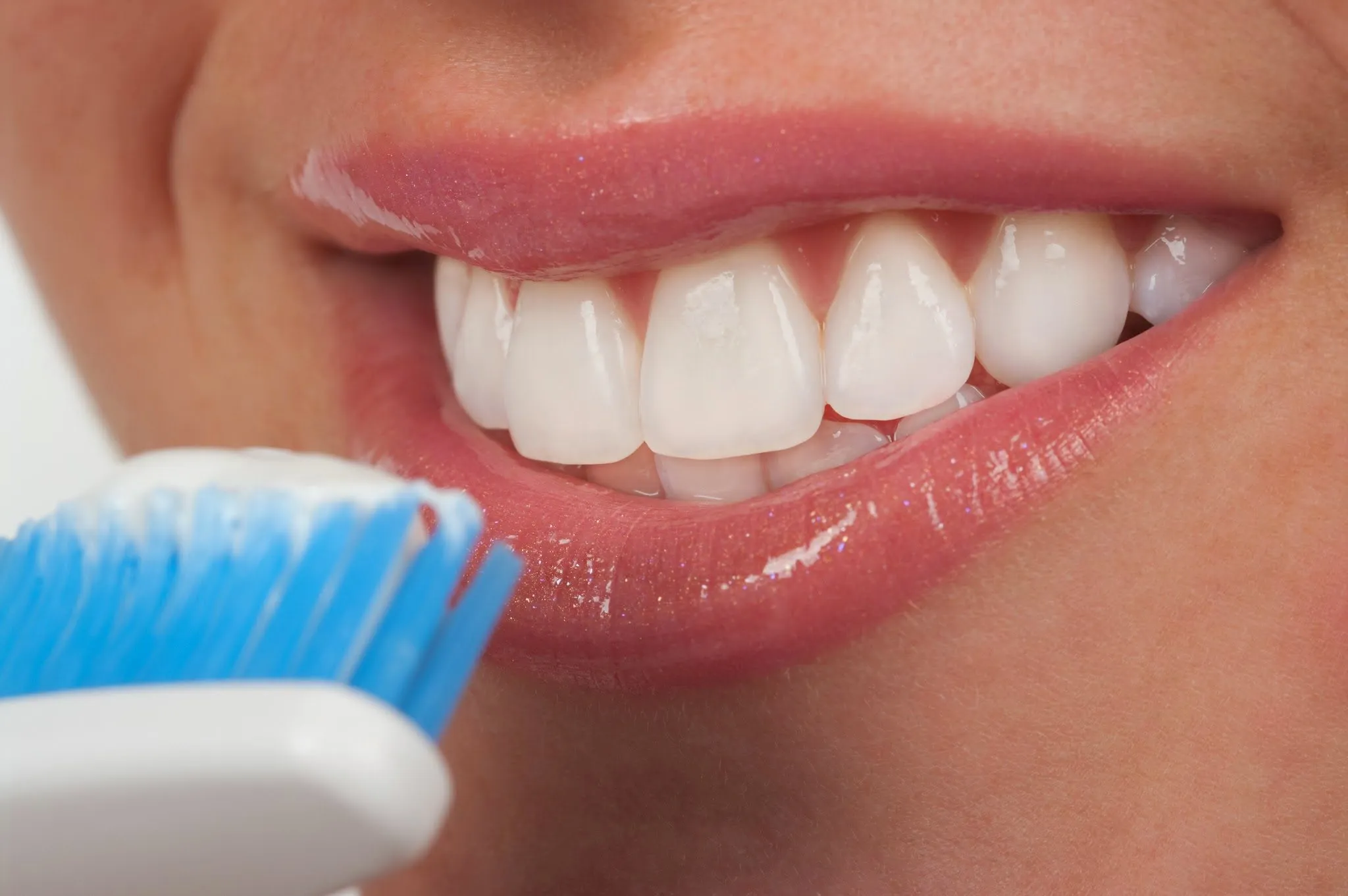 dentes brancos