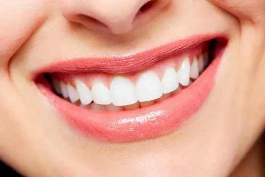 Clareamento Dental: O Guia Definitivo para Dentes Perfeitos