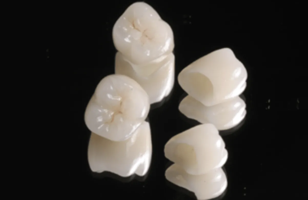 Tipos de Coroa Dentária