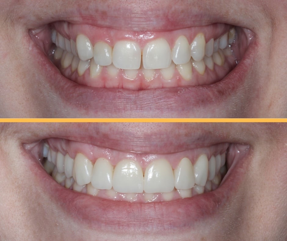 Transformação Dental - Sorriso Renovado